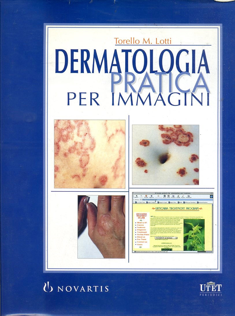 LZ- DERMATOLOGIA PRATICA PER IMMAGINI - TORELLO LOTTI - UTET--- 2000- CS- YFS134