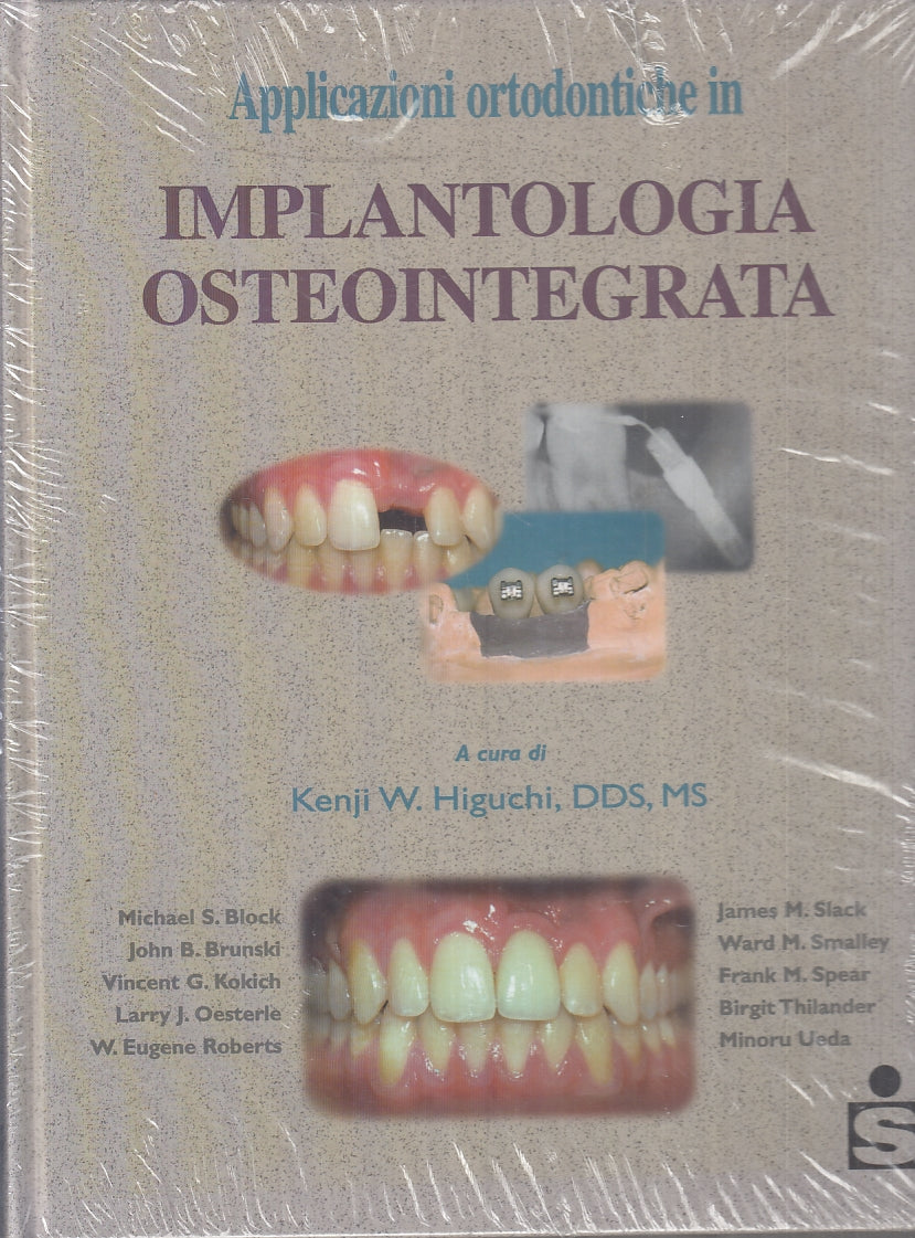 LQ- APPLICAZIONI ORTODONTICHE IN IMPLANTOLOGIA OSTEOINTEGRATA- HIGUCHI- C-YFS516