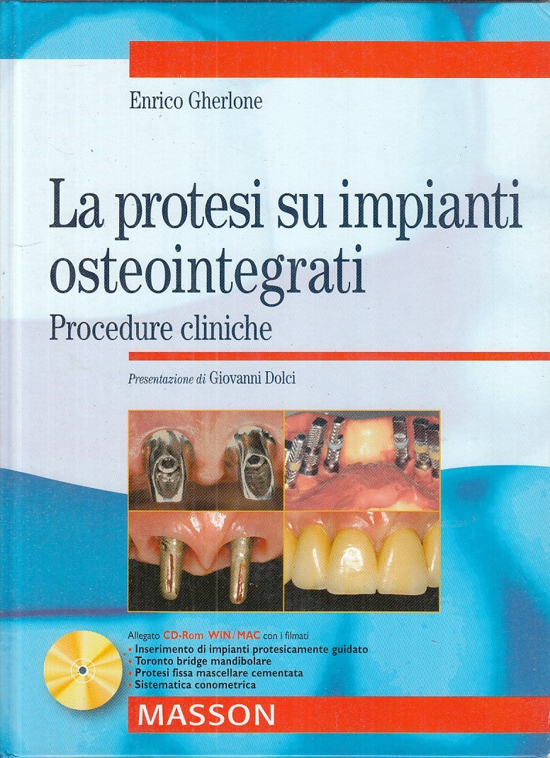 LQ- LA PROTESI SU IMPIANTI OSTEOINTEGRATI- GHERLONE- MASSON--- 2004 - C - YFS740