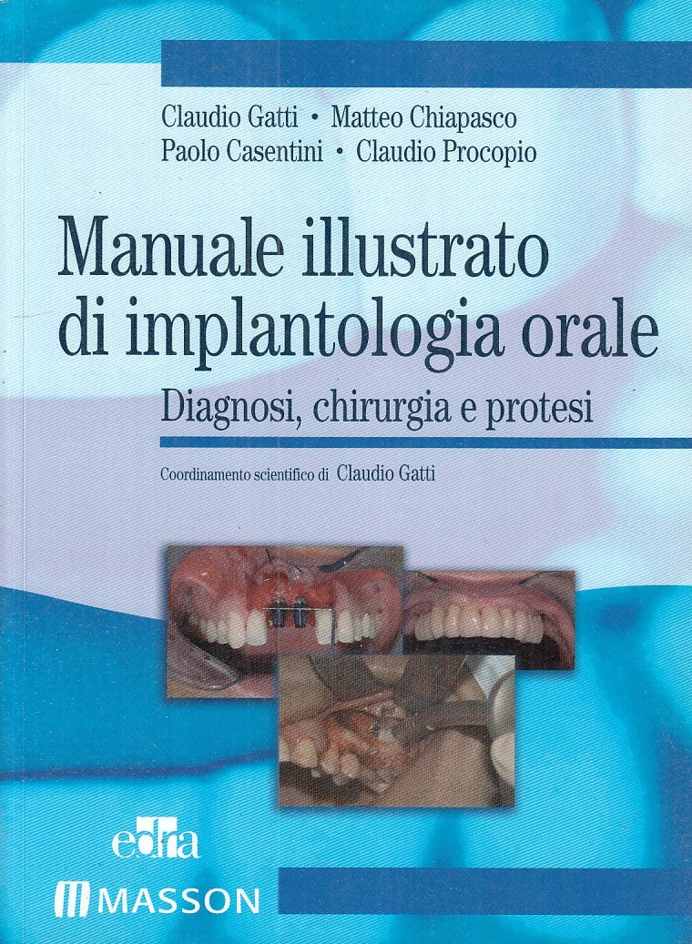 LQ- MANUALE ILLUSTRATO DI IMPLANTOLOGIA ORALE -- EDRA/MASSON--- 2013- B - YFS740