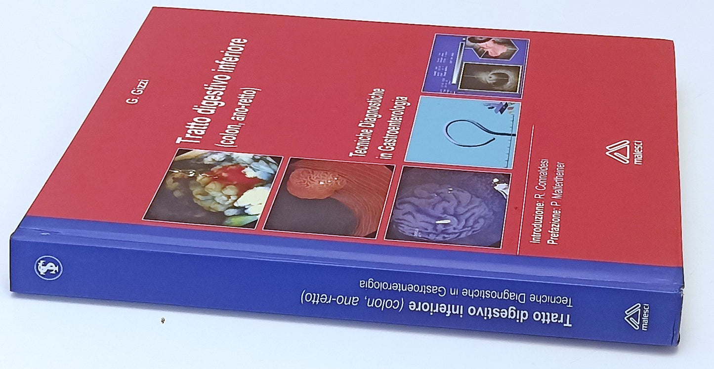 LZ- TRATTO DIGESTIVO INFERIORE GASTROENTEROLOGIA- GIZZI- MALESCI- 2005- C-YFS528