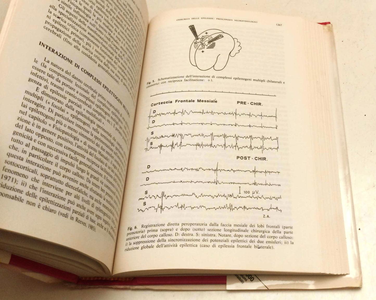 LQ- MANUALE ITALIANO DI EPILETTOLOGIA -- PICCIN --- 1993 - CS - YFS32