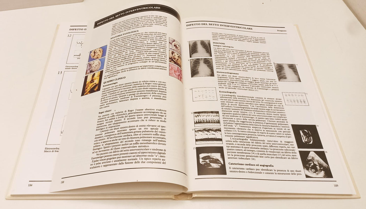 LQ- ATLANTE A COLORI DI PATOLOGIA CARDIACA- SUTTON FOX- SANDOZ--- 1991- C-YFS122