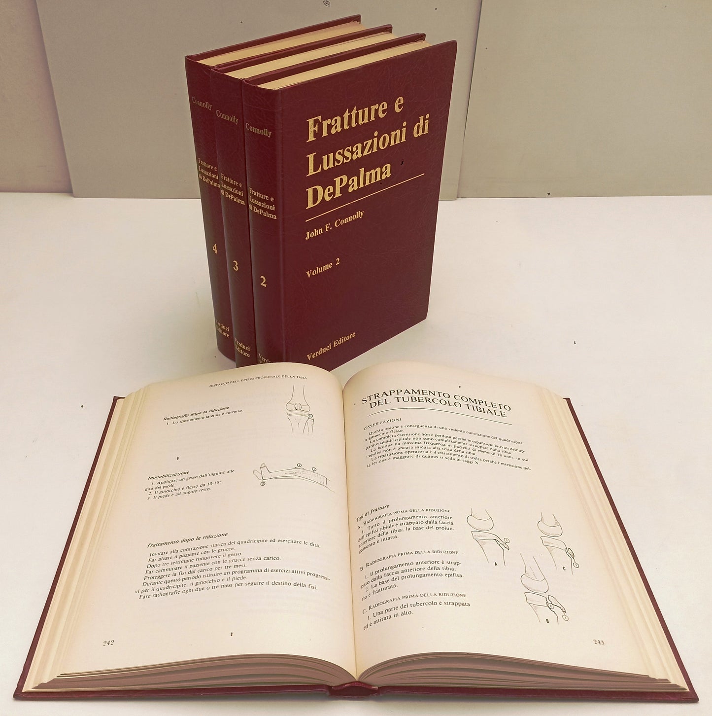 LQ- FRATTURE E LUSSAZIONI DI DEPALMA 4 VOLUMI- CONNOLLY- VERDUCI- 1982- C-BLCP73