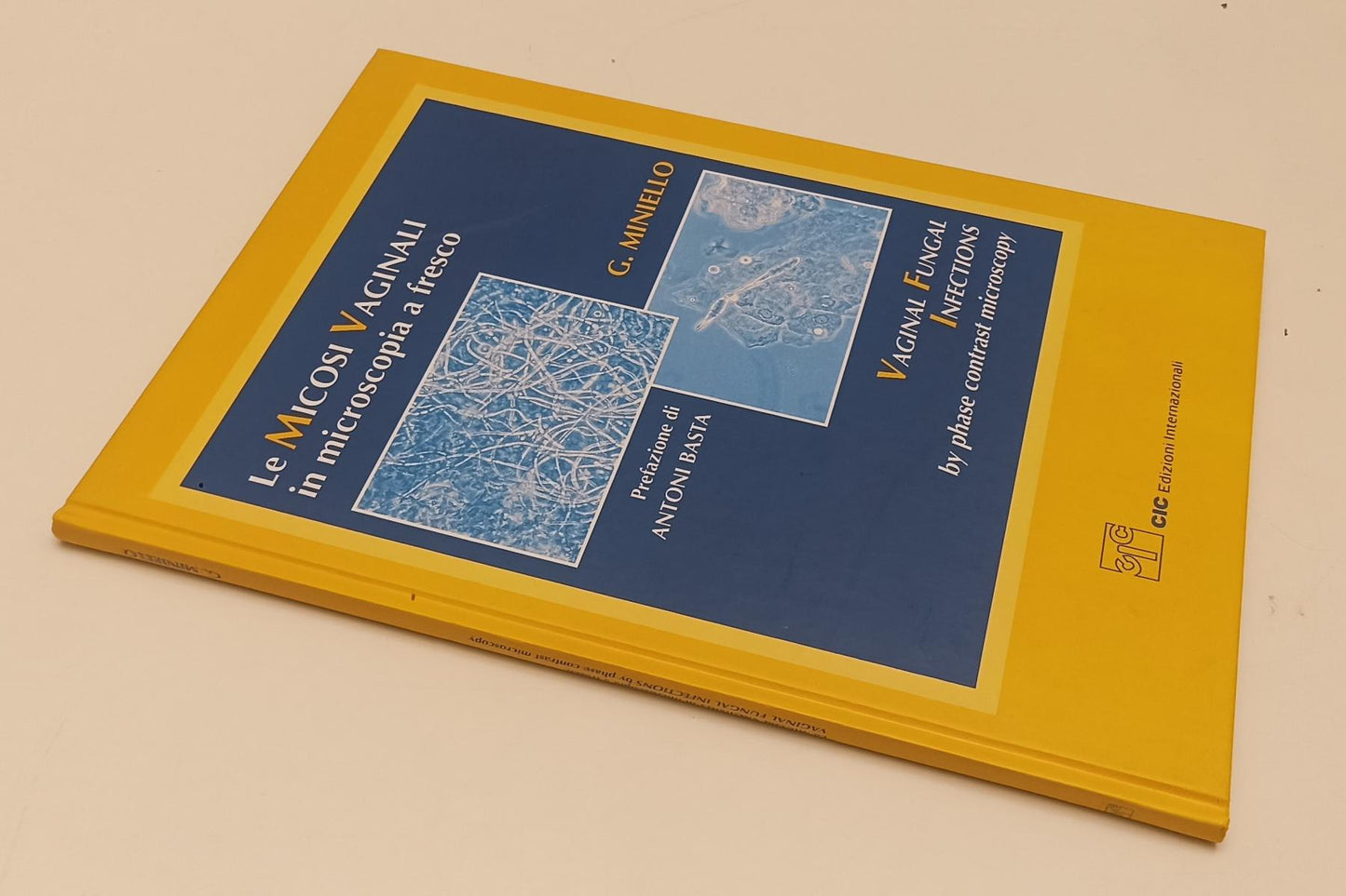 LQ- LE MICOSI VAGINALI IN MICROSCOPIA A FRESCO- MINIELLO- CIC--- 2001- C- YFS242