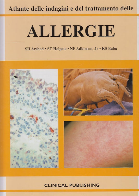 LZ- ATLANTE INDAGINI E TRATTAMENTO ALLERGIE -- CLNICAL --- 2005 - C - YDS556
