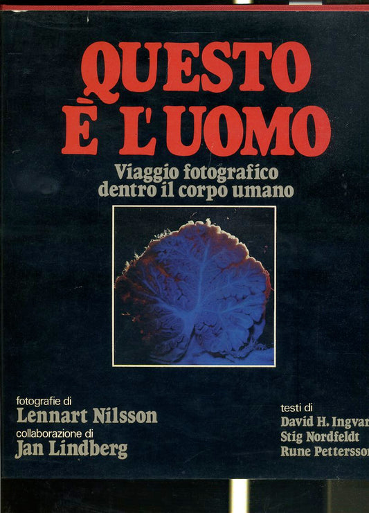 LZ- QUESTO E' L'UOMO - LENNART NILSSON - PAOLINE --- 1981 - CS - YFS244