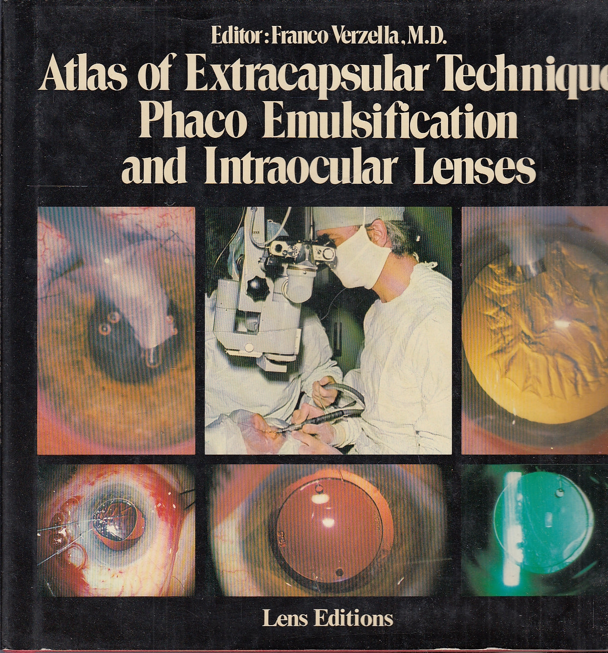 LZ- ATLAS EXTRACAPSULAR TECHNIQUE PHACO EMULSIFICATION-- LENS--- 1981- CS-YFS244