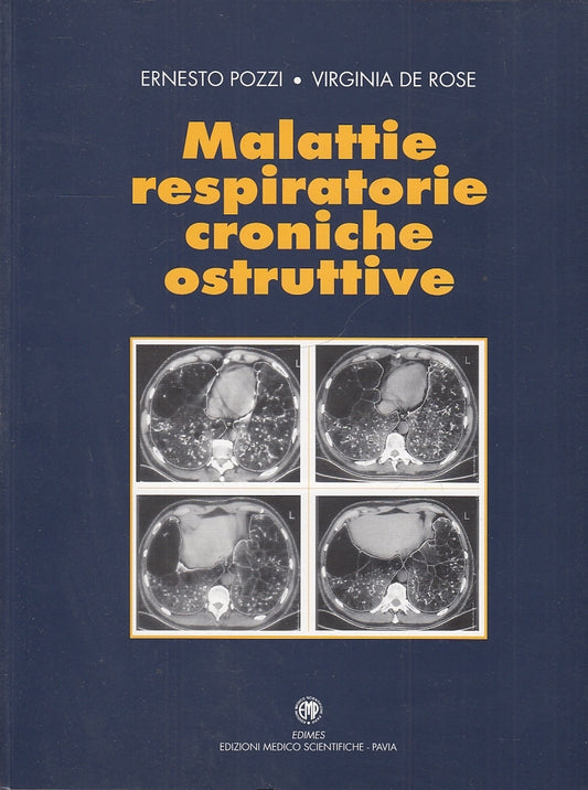 LZ- MALATTIE RESPIRATORIE CRONICHE OSTRUTTIVE - POZZI- EDIMES--- 1996- B- YFS673