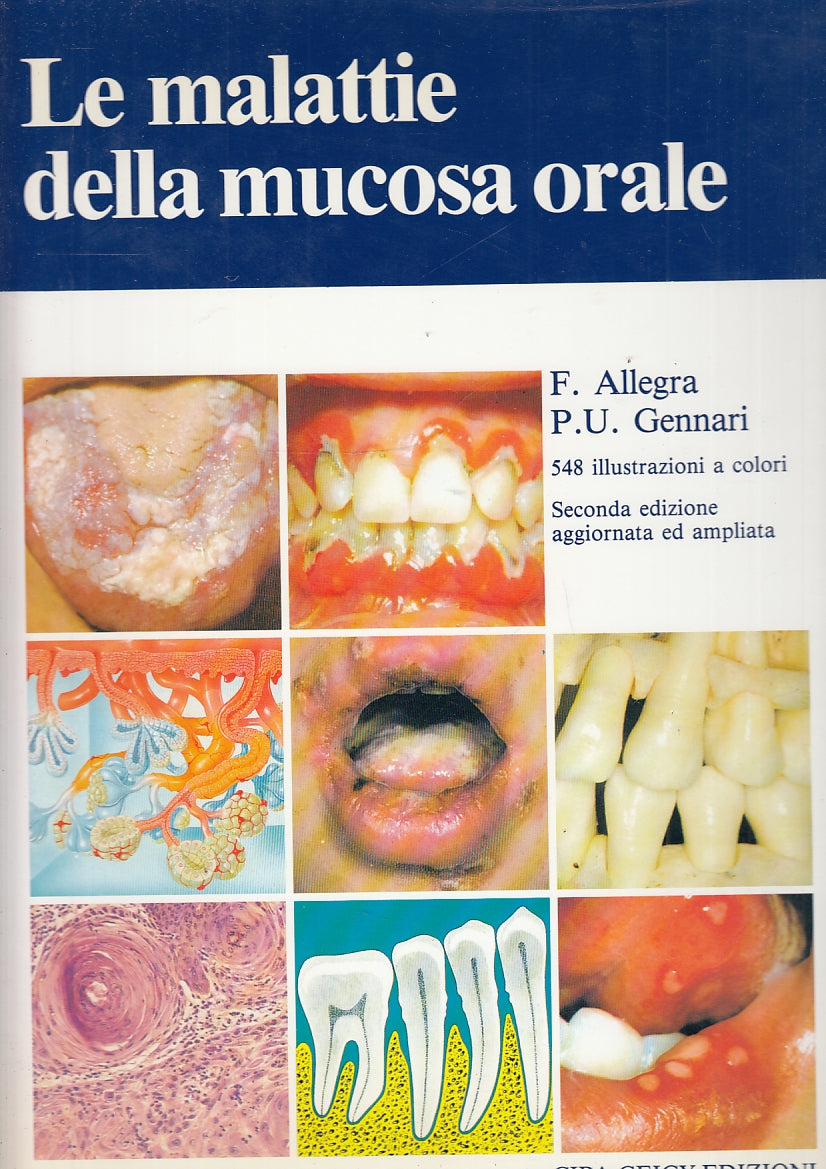 LZ- LE MALATTIE DELLA MUCOSA ORALE - GENNARI- CIBA GEIGY-- 2a - 1991- CS- ZFS581