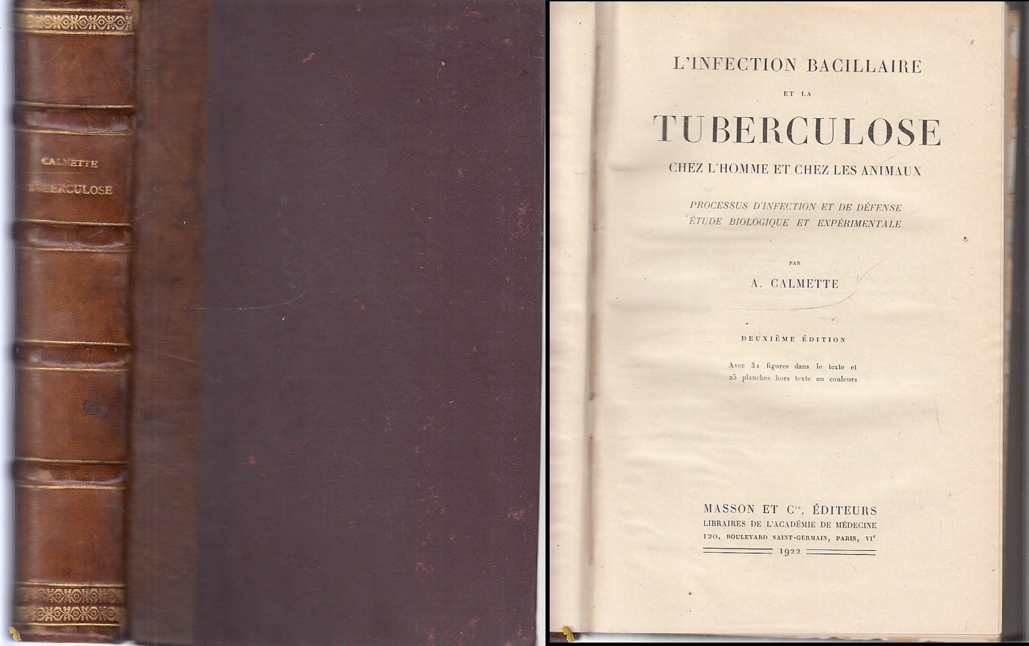 LH- L'INFECTION TUBERCULOSE - CALMETTE - MASSON ET C. EDITEURS--- 1922- C- XFS54