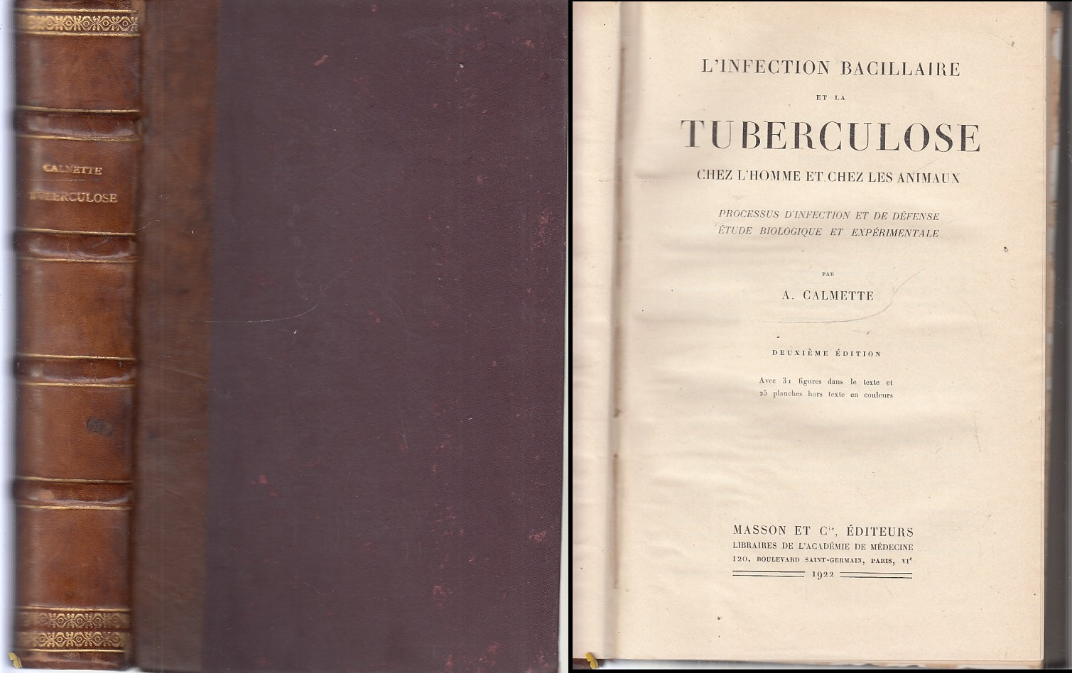 LH- L'INFECTION TUBERCULOSE - CALMETTE - MASSON ET C. EDITEURS--- 1922- C- XFS54