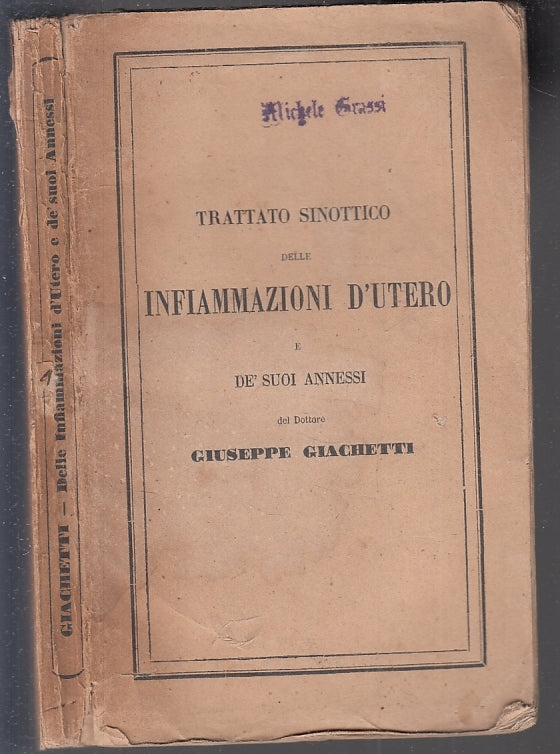 LH- TRATTATO SINOTTICO DELLE INFIAMMAZIONI D'UTERO- GIACHETTI---- 1856- B- XFS63