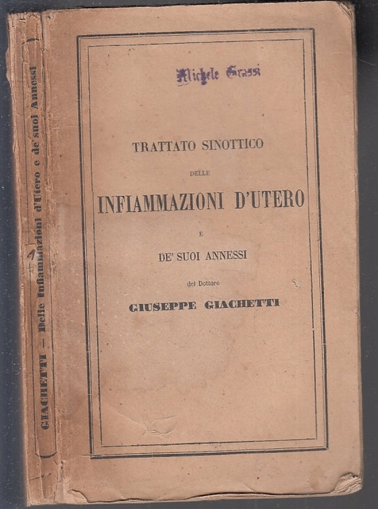LH- TRATTATO SINOTTICO DELLE INFIAMMAZIONI D'UTERO- GIACHETTI---- 1856- B- XFS63