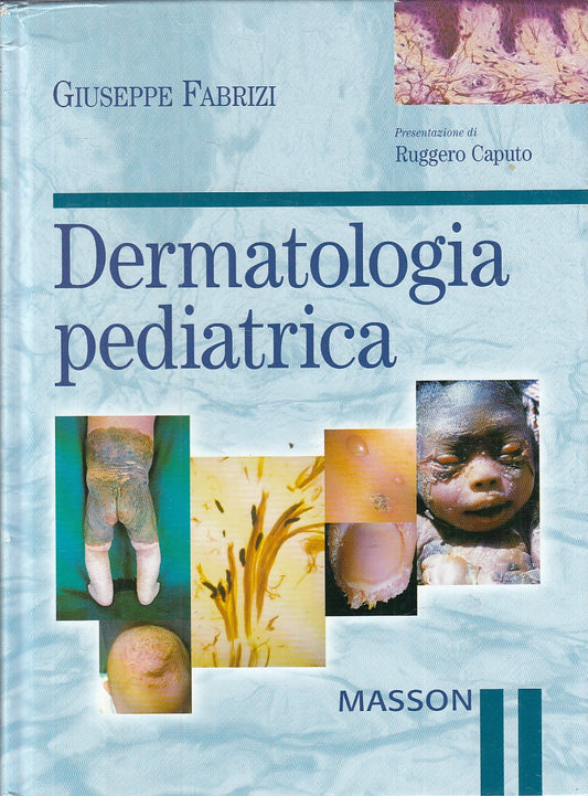 LZ- DERMATOLOGIA PEDIATRICA - FABRIZI - MASSON --- 2004 - C - YFS859
