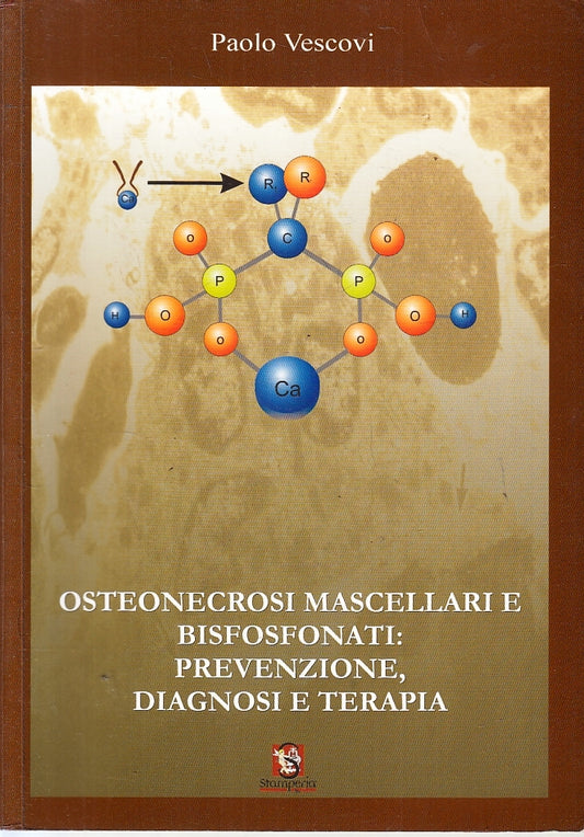 LQ- OSTEONECROSI MASCELLARI E BISFOSFONATI - PAOLO VESCOVI ---- 2007 - B - ZFS92