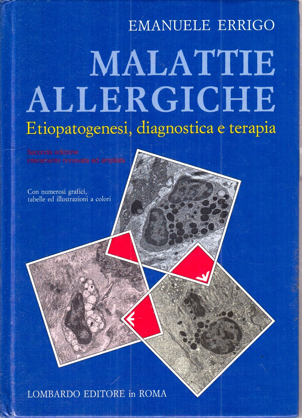 LQ- MALATTIE ALLERGICHE - EMANUELE ERRIGO - LOMBARDO--- 1994- C- ZFS184