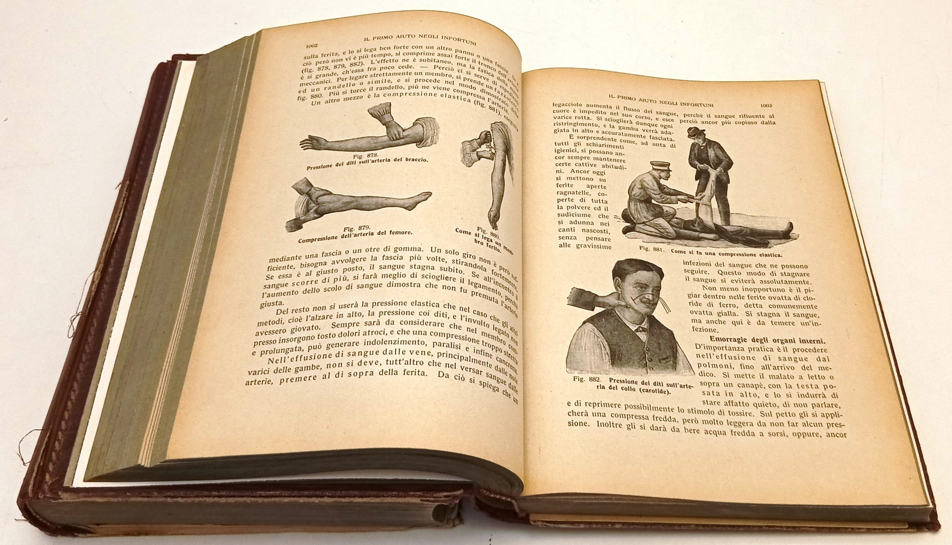 La medichessa in casa 2 volumi- Dr. Henry Springer- Carlo Moscheni- 1928- ZFS250