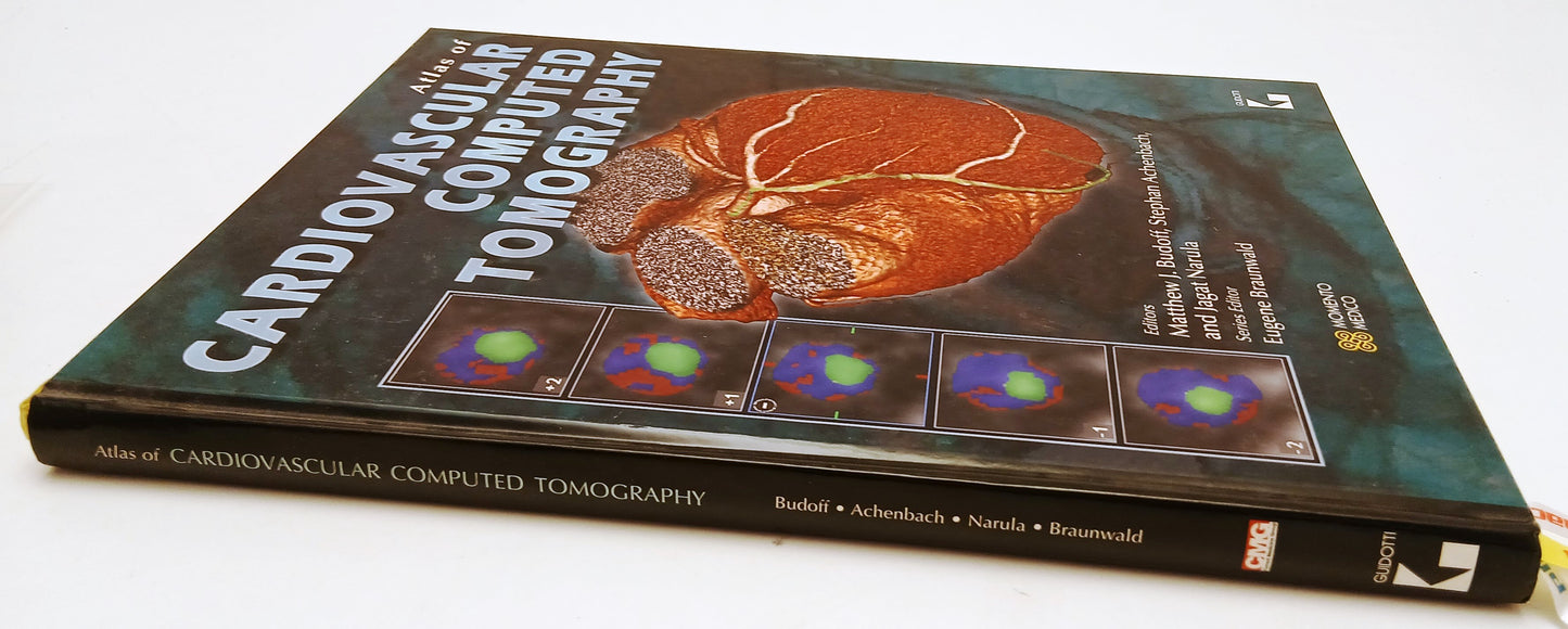 LQ- ATLAS OF CARDIOVASCULAR COMPUTED TOMOGRAPHY -- GUIDOTTI --- 2008 - C- YFS703