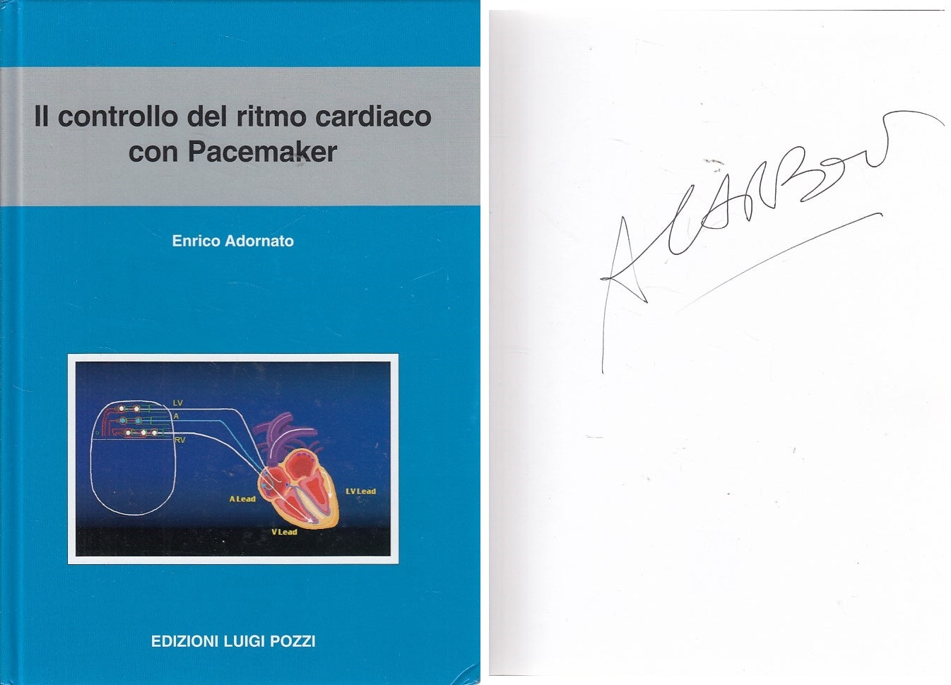LZ- CONTROLLO RITMO CARDIACO CON PACEMAKER- ADORNATO- POZZI --- 2004 - C - ZDS99