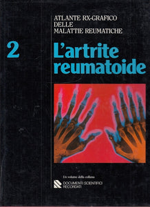 LQ- L'ARTRITE REUMATOIDE 2- CARUSO COSTA- RICORDI- ATLANTE RX-- 1985- CS- ZFS681